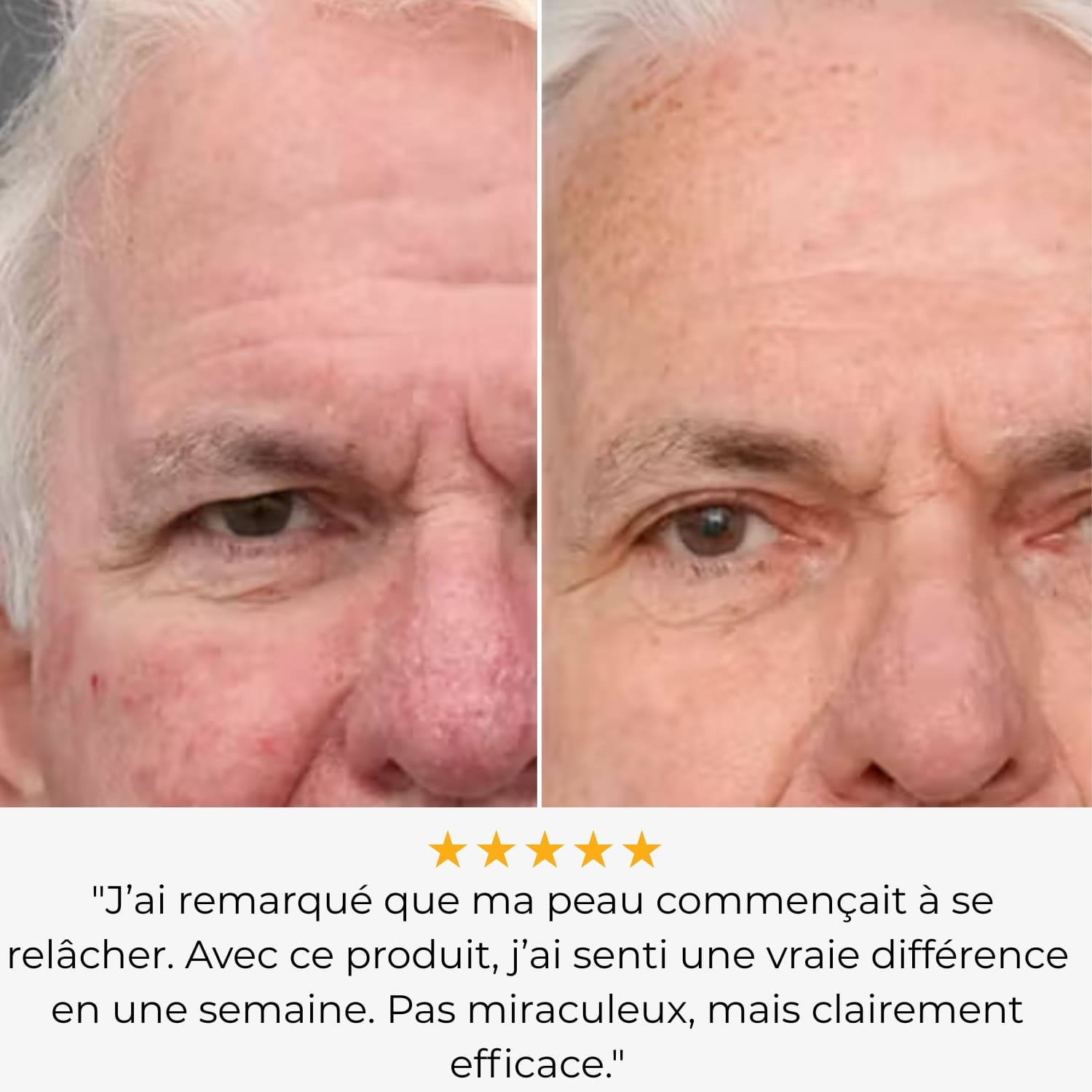 Rejuven