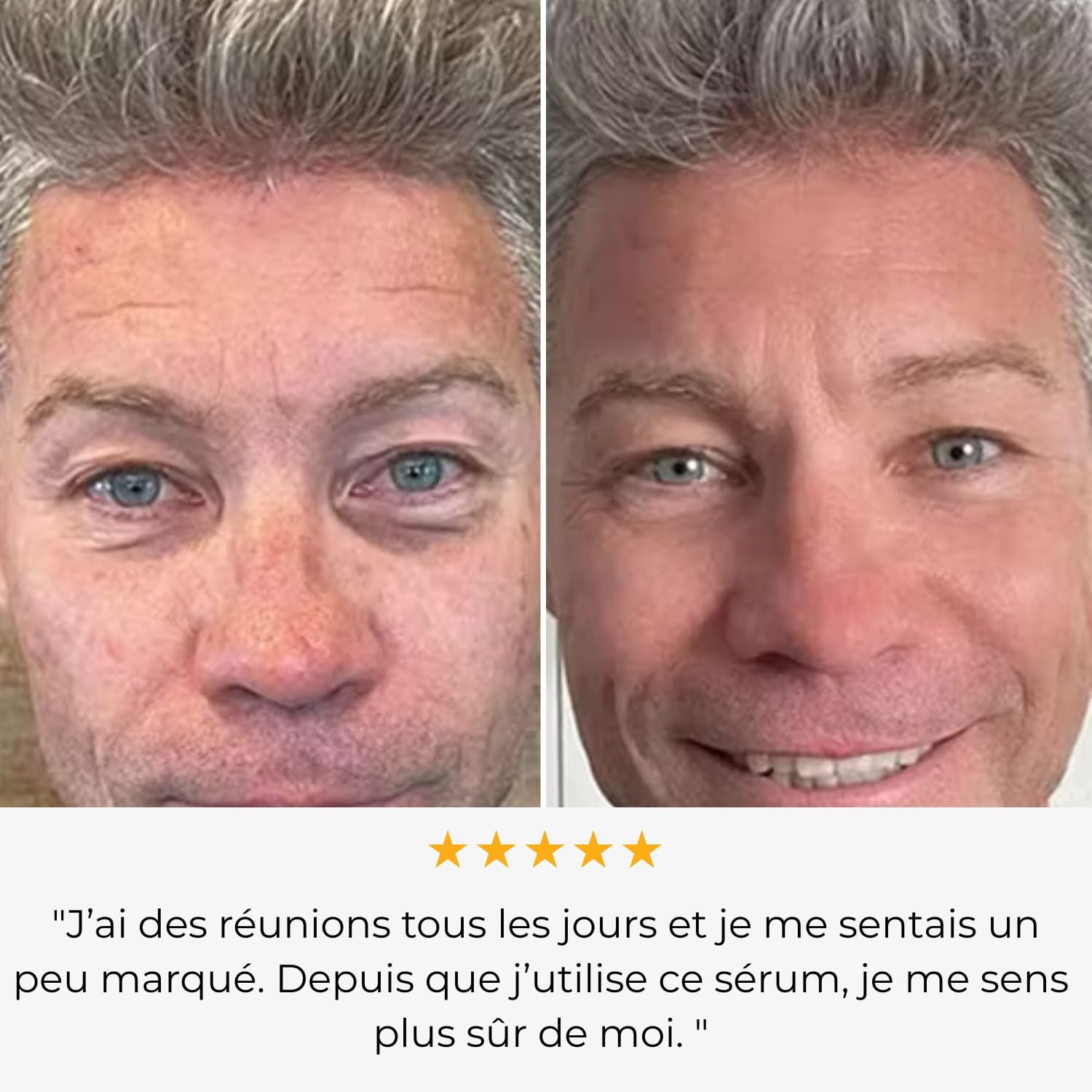 Rejuven